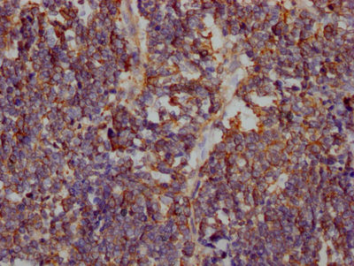 Thumbnail: SLC2A1 Antibody