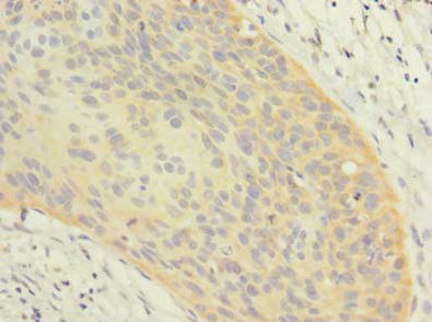Thumbnail: OXR1 Antibody