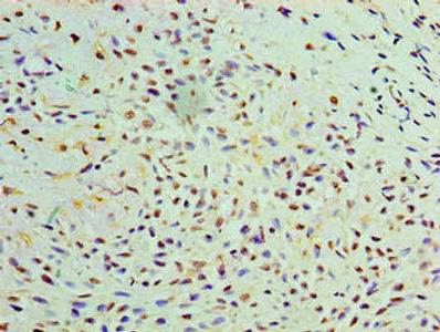 Thumbnail: GALE Antibody