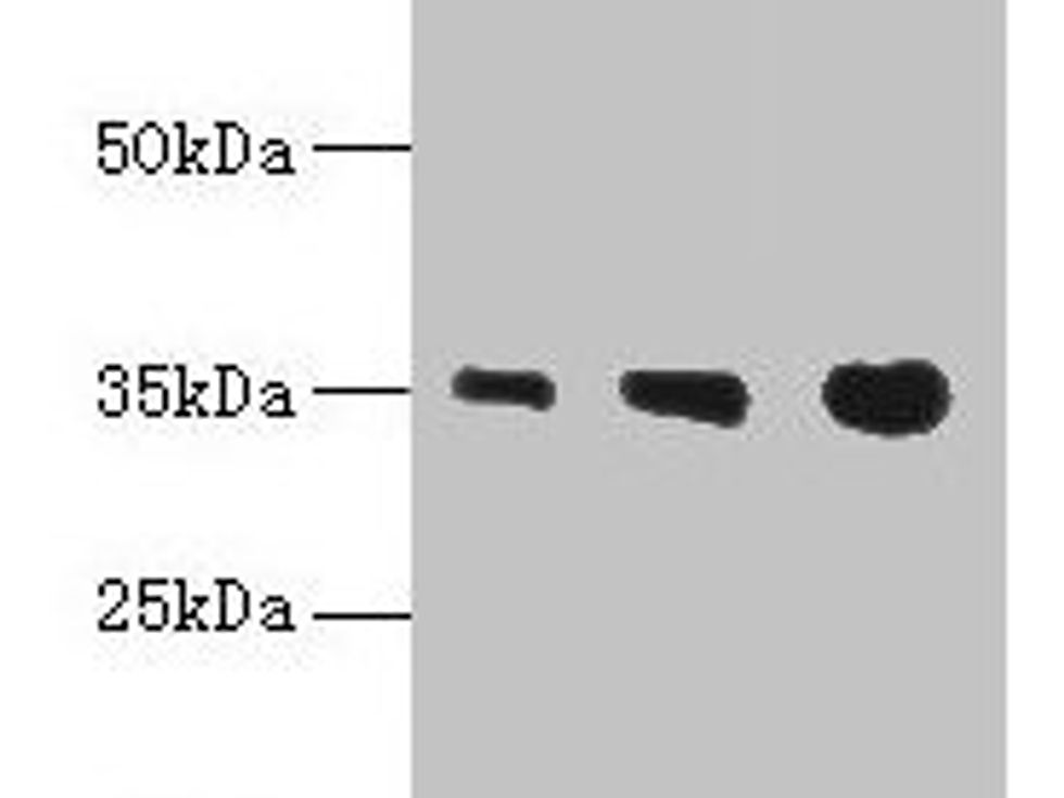 PVRIG Antibody
