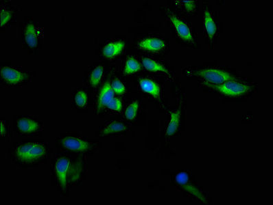 Thumbnail: CALR Antibody