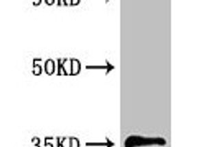 PPT1 Antibody