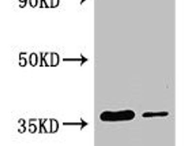 GRHPR Antibody