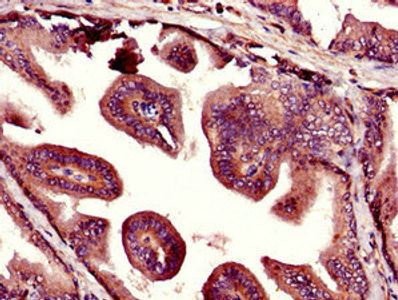 Thumbnail: UHMK1 Antibody
