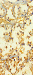 Thumbnail: ATOH1 Antibody