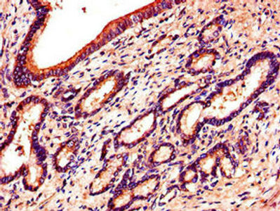 Thumbnail: EPHB6 Antibody