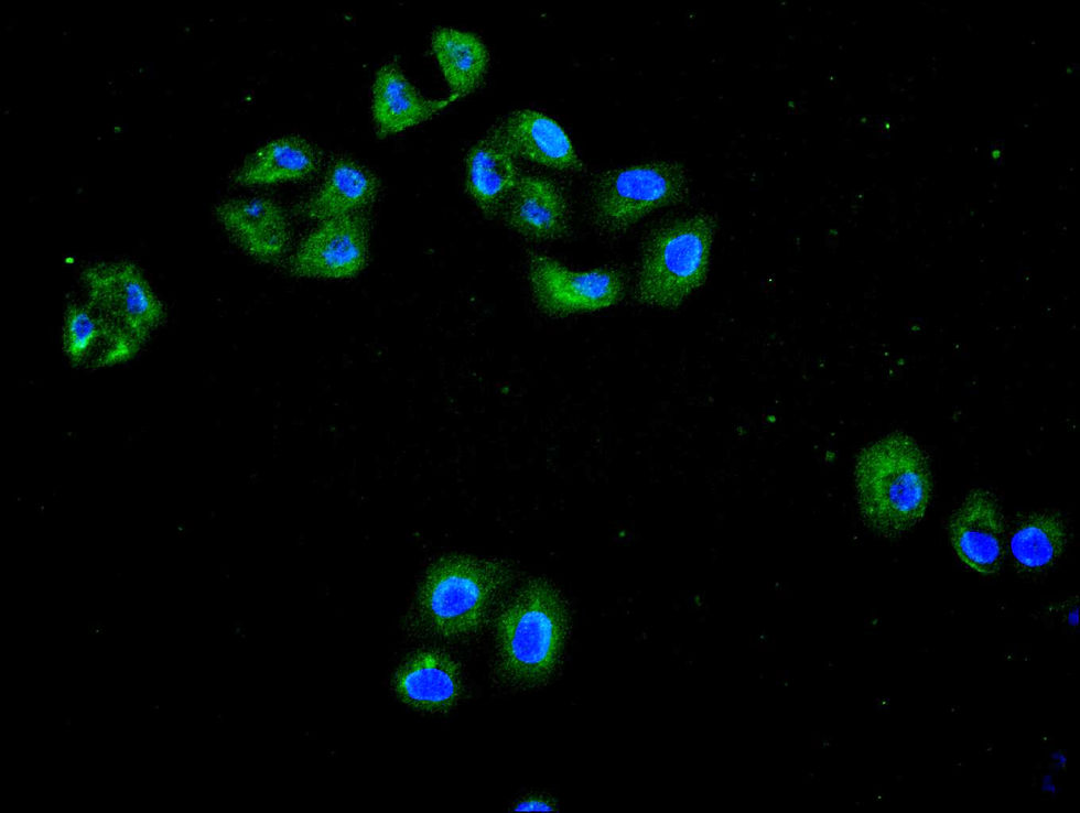 Thumbnail: SYP Recombinant Monoclonal Antibody