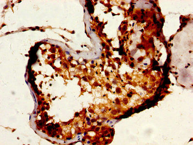 Thumbnail: RUVBL1 Antibody