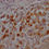 Thumbnail: GSK3B Antibody