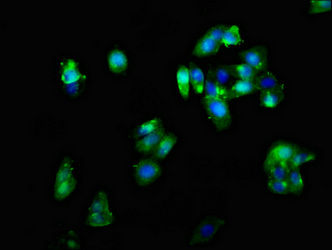 Thumbnail: CRHR2 Antibody