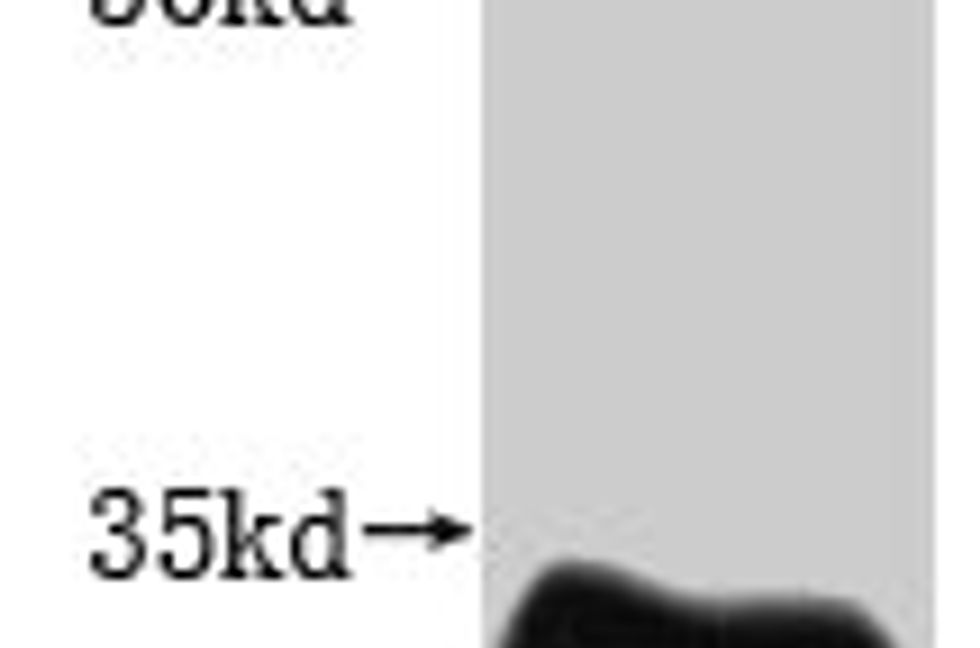 Thumbnail: Recombinant Human Claudin-18.2 (CLDN18.2)-VLPs (Active)