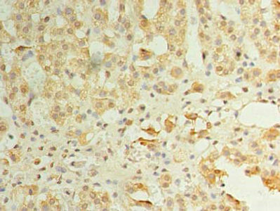 Thumbnail: ZDHHC3 Antibody