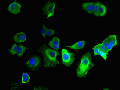 Thumbnail: GABRQ Antibody