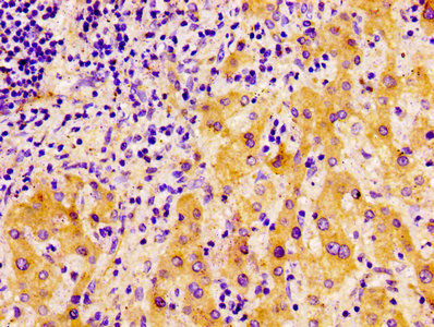 Thumbnail: FASN Antibody