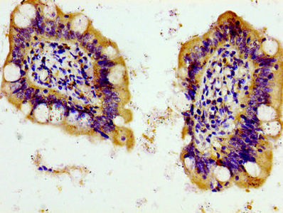 Thumbnail: PANX1 Antibody