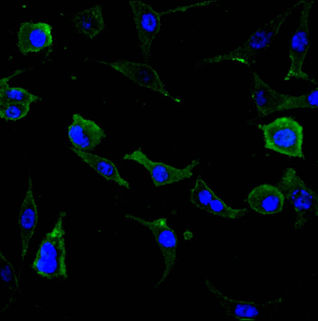 Thumbnail: PLAUR Recombinant Monoclonal Antibody
