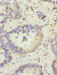 Thumbnail: VANGL2 Antibody