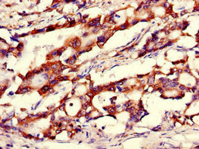 Thumbnail: CANX Antibody