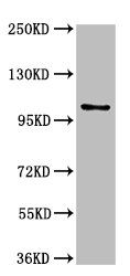Thumbnail: AMPD2 Antibody