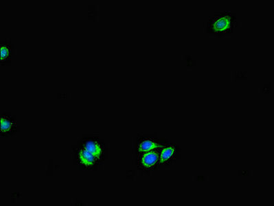 Thumbnail: UVRAG Antibody