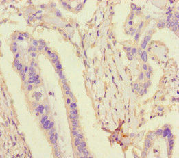 Thumbnail: TDRD3 Antibody