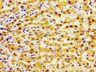 Thumbnail: GRK5 Antibody