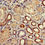 Thumbnail: COQ8B Antibody