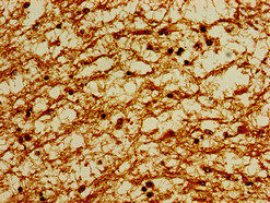 Thumbnail: POU3F1 Antibody