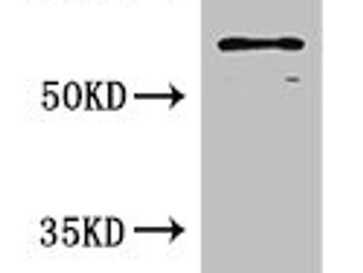 SLC6A3 Antibody