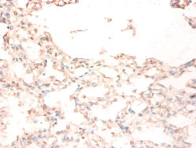 STEAP1 Antibody