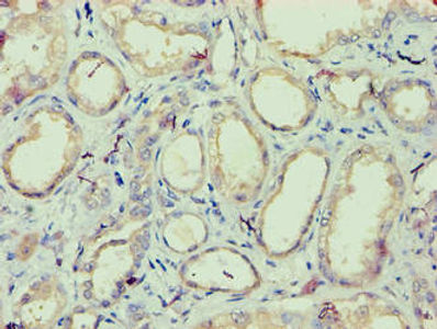 Thumbnail: IZUMO4 Antibody