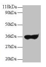 IgG Antibody