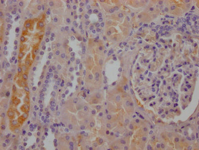 Thumbnail: RBP4 Antibody