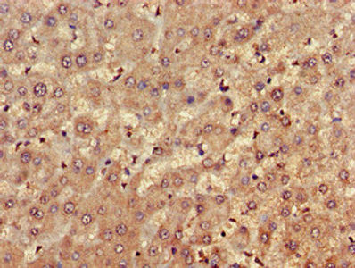 Thumbnail: FARP1 Antibody
