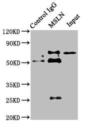 Thumbnail: MSLN Antibody