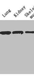 Thumbnail: Ces1c Antibody