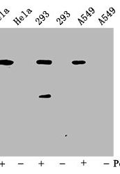Phospho-PTPN11 (Y542) Antibody