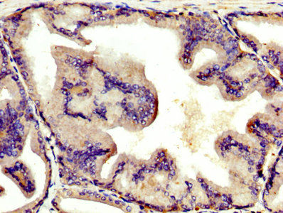 Thumbnail: AGT Antibody