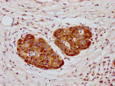 Thumbnail: YWHAZ Antibody
