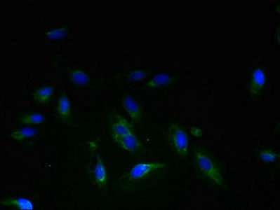 Thumbnail: STEAP3 Antibody