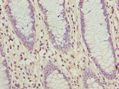 Thumbnail: SLC30A6 Antibody