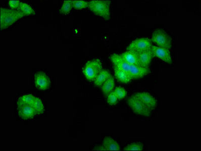 Thumbnail: THEMIS Antibody