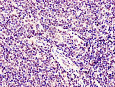 Thumbnail: SMARCD1 Antibody