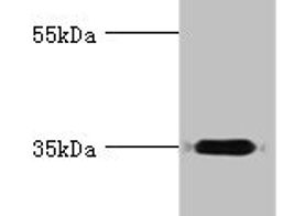 DIMT1 Antibody