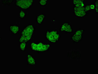 Thumbnail: UHMK1 Antibody