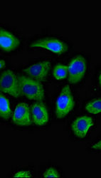 Thumbnail: CCR10 Antibody