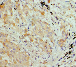 Thumbnail: HIST2H3A Antibody
