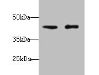 VPS45 Antibody