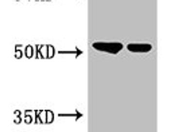 GCNT3 Antibody