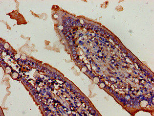 Thumbnail: FBXW2 Antibody